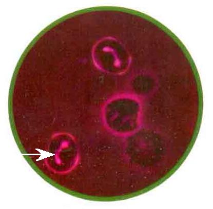 inficirani eritrocit